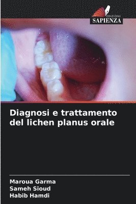 Diagnosi e trattamento del lichen planus orale 1