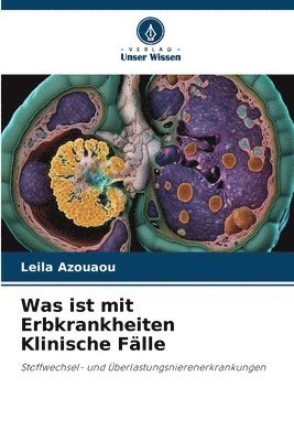 bokomslag Was ist mit Erbkrankheiten Klinische Flle