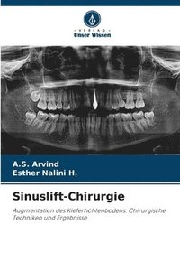 bokomslag Sinuslift-Chirurgie