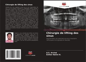 Chirurgie de lifting des sinus 1