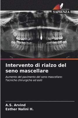 bokomslag Intervento di rialzo del seno mascellare