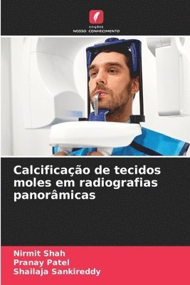 bokomslag Calcificação de tecidos moles em radiografias panorâmicas