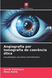 bokomslag Angiografia por tomografia de coerência ótica