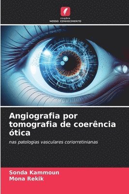 bokomslag Angiografia por tomografia de coerência ótica