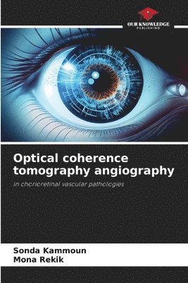 bokomslag Optical coherence tomography angiography