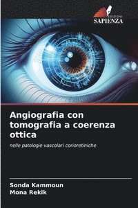 bokomslag Angiografia con tomografia a coerenza ottica