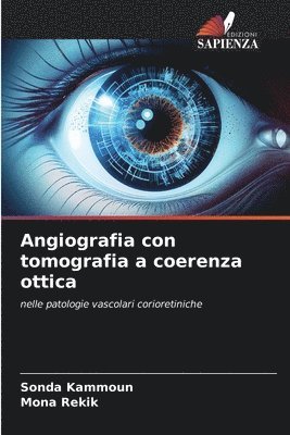 Angiografia con tomografia a coerenza ottica 1