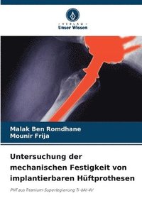 bokomslag Untersuchung der mechanischen Festigkeit von implantierbaren Hftprothesen