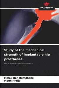 bokomslag Study of the mechanical strength of implantable hip prostheses