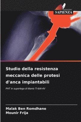 bokomslag Studio della resistenza meccanica delle protesi d'anca impiantabili