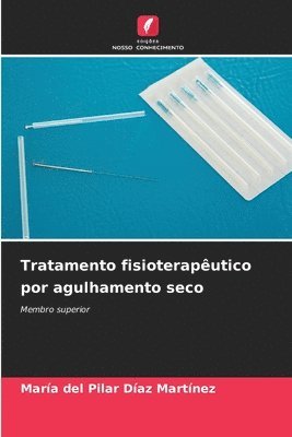 bokomslag Tratamento fisioterapêutico por agulhamento seco