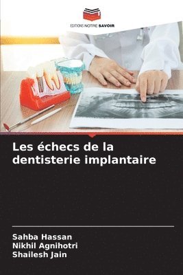 Les échecs de la dentisterie implantaire 1