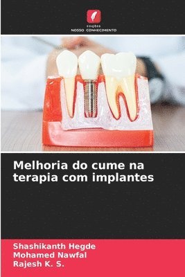 Shashikanth Hegde, Mohamed Nawfal, Rajesh K S, MOHAMED NAWFAL, Rajesh K. S. - Melhoria do cume na terapia com implantes, Häftad