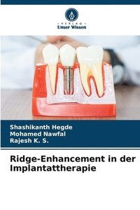 bokomslag Ridge-Enhancement in der Implantattherapie