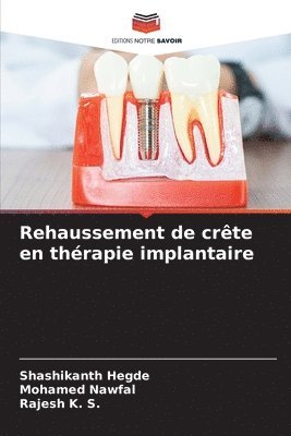 Rehaussement de crte en thrapie implantaire 1