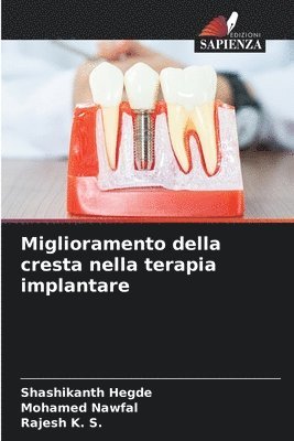 Shashikanth Hegde, Mohamed Nawfal, Rajesh K S, MOHAMED NAWFAL, Rajesh K. S. - Miglioramento della cresta nella terapia implantare, Häftad