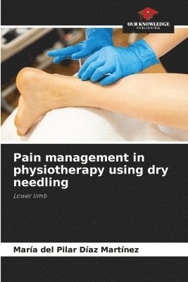 Pain management in physiotherapy using dry needling
