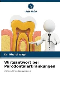 bokomslag Wirtsantwort bei Parodontalerkrankungen