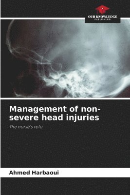 bokomslag Management of non-severe head injuries