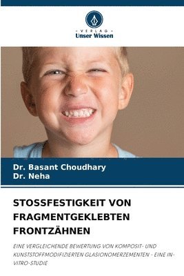 bokomslag Stossfestigkeit Von Fragmentgeklebten Frontzähnen