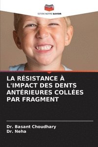 bokomslag La Rsistance  l'Impact Des Dents Antrieures Colles Par Fragment