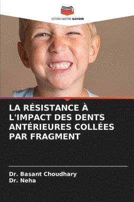 bokomslag Résistance À l'Impact Des Dents Antérieures Collées Par Fragment