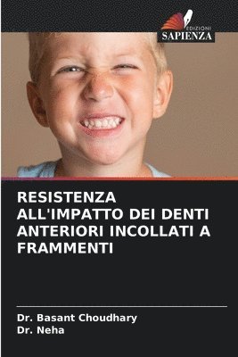 Resistenza All'impatto Dei Denti Anteriori Incollati a Frammenti