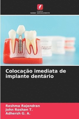 Reshma Rajendran, John Roshan, Adhersh G a, John Roshan  T., John Roshan T., Adhersh G. A. - Colocação imediata de implante dentário, Häftad