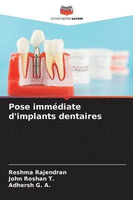 bokomslag Pose immdiate d'implants dentaires