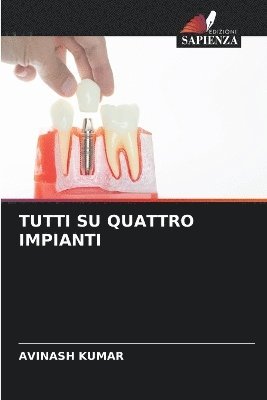 Avinash Kumar - Tutti Su Quattro Impianti, Häftad