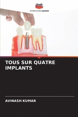 Avinash Kumar - Tous Sur Quatre Implants, Häftad