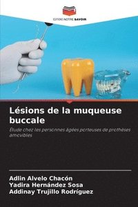 bokomslag Lsions de la muqueuse buccale