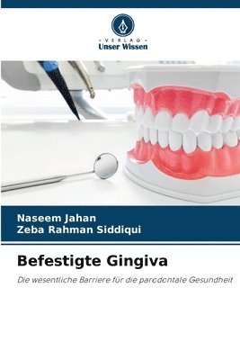 Befestigte Gingiva