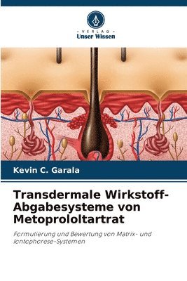 bokomslag Transdermale Wirkstoff-Abgabesysteme von Metoprololtartrat