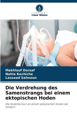 Verdrehung des Samenstrangs bei einem ektopischen Hoden