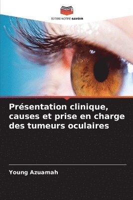 bokomslag Présentation clinique, causes et prise en charge des tumeurs oculaires