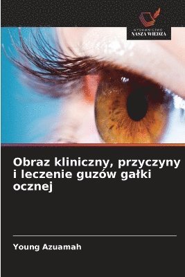 bokomslag Obraz kliniczny, przyczyny i leczenie guzw galki ocznej