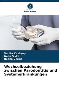 bokomslag Wechselbeziehung zwischen Parodontitis und Systemerkrankungen