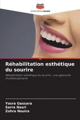 Rhabilitation esthtique du sourire 1