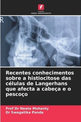 bokomslag Recentes conhecimentos sobre a histiocitose das clulas de Langerhans que afecta a cabea e o pescoo