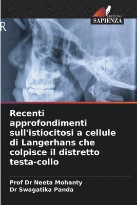 Recenti approfondimenti sull'istiocitosi a cellule di Langerhans che colpisce il distretto testa-collo 1