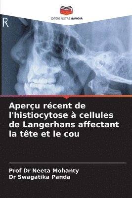 Aperçu récent de l'histiocytose à cellules de Langerhans affectant la tête et le cou