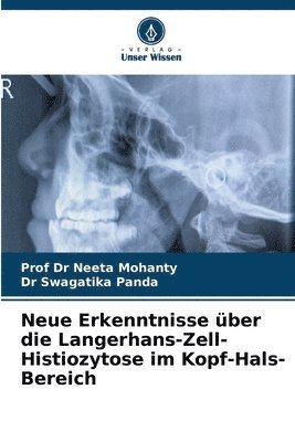 Mohanty, Swagatika Panda, Neeta Mohanty, Prof Dr Neeta Mohanty, Dr Swagatika Panda - Neue Erkenntnisse über die Langerhans-Zell-Histiozytose im Kopf-Hals-Bereich, Häftad