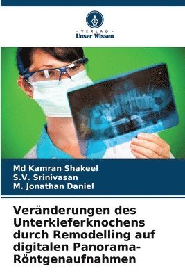 bokomslag Veränderungen des Unterkieferknochens durch Remodelling auf digitalen Panorama-Röntgenaufnahmen