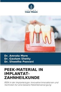 bokomslag Peek-Material in Implantat-Zahnheilkunde