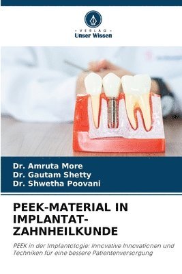 Peek-Material in Implantat-Zahnheilkunde 1