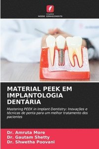 bokomslag Material Peek Em Implantologia Dentria