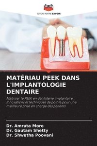 bokomslag Matriau Peek Dans l'Implantologie Dentaire