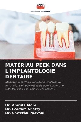 bokomslag Matriau Peek Dans l'Implantologie Dentaire