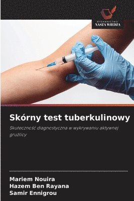 bokomslag Skrny test tuberkulinowy